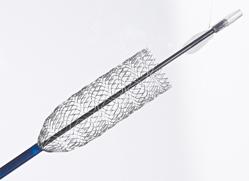 fda-ide-approval-for-veniti-vici-venous-stent-system