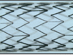 CGuardians II shows positive 30-day outcomes for carotid stent use in TCAR procedures