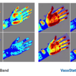 Fig 1 and 2 VasoStat combined