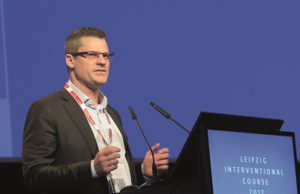 DANCE trial shows positive results for micro-infusion device with dexamethasone