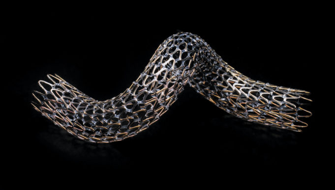 Gore Tigris vascular stent demonstrates high patency rates at 12 months