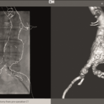 CYDAR fusion imaging