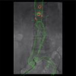Xray-With-Overlay CYDAR