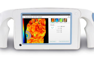 HyperMed Imaging announces US sales availability of HyperView