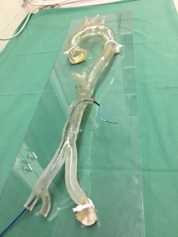 Stratasys 3d printed aortic arch