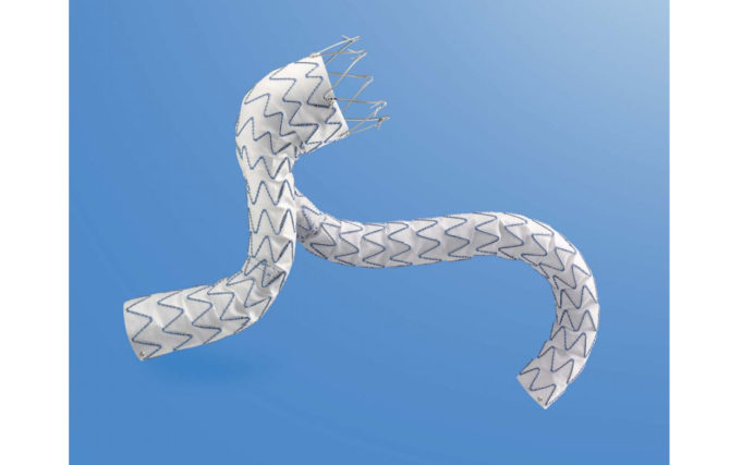 Medtronic launches ChEVAR parallel graft technique study using Endurant II/IIs