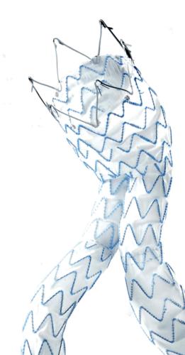 ENCHANT will evaluate ChEVAR technique with Endurant II/IIs stent graft system