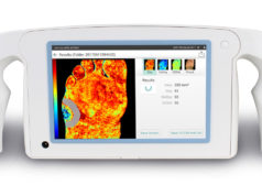 Handheld superficial perfusion imaging system gets CE mark