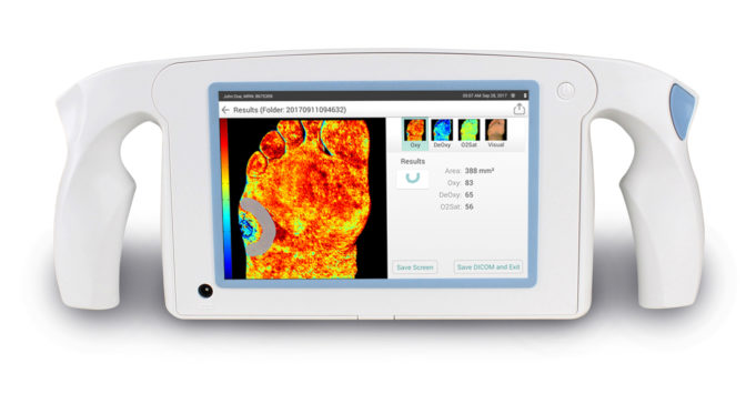 Handheld superficial perfusion imaging system gets CE mark