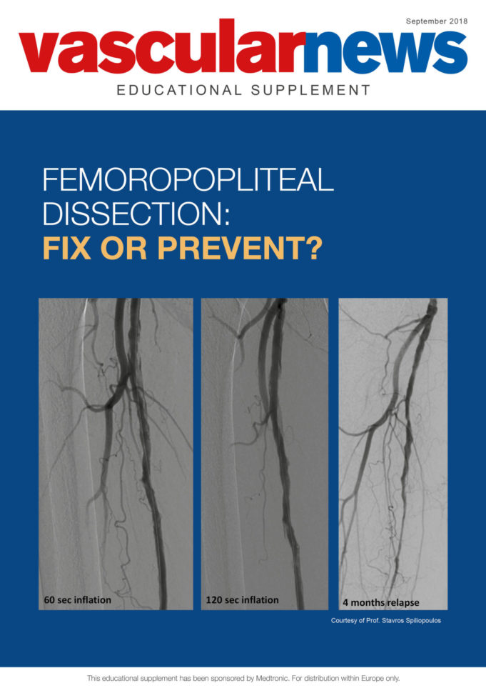 Femoropopliteal dissection: Fix or prevent?