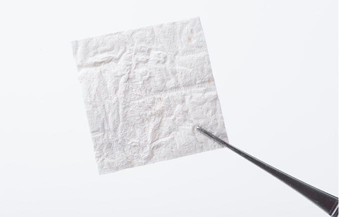 Enrolment starts for efficacy study of human placental graft for diabetic foot ulcers