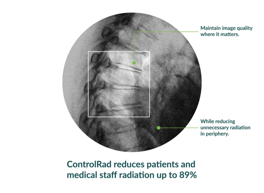 ControlRad