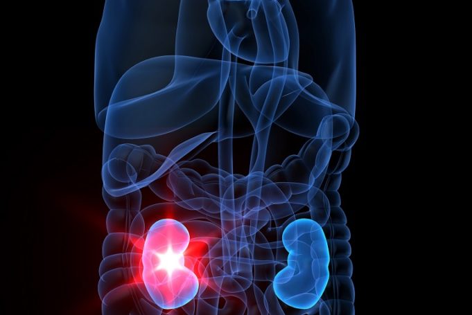 Tunnelled dialysis catheter insertions without fluoroscopy deemed safe and effective in selected patients