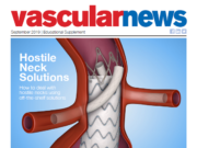 Vascular News supplement how to deal with hostile necks