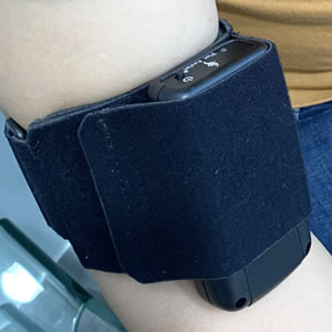 Global FACT trial reports significant superficial arm vein dilation with FA-1 device Fist Assist device