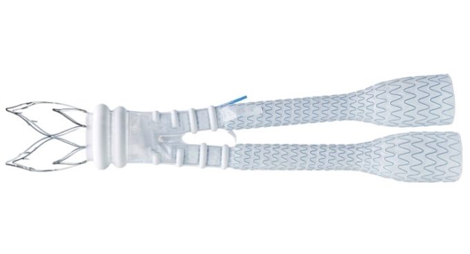 Endologix initiates randomised study of Alto abdominal stent graft system Endologix Alto