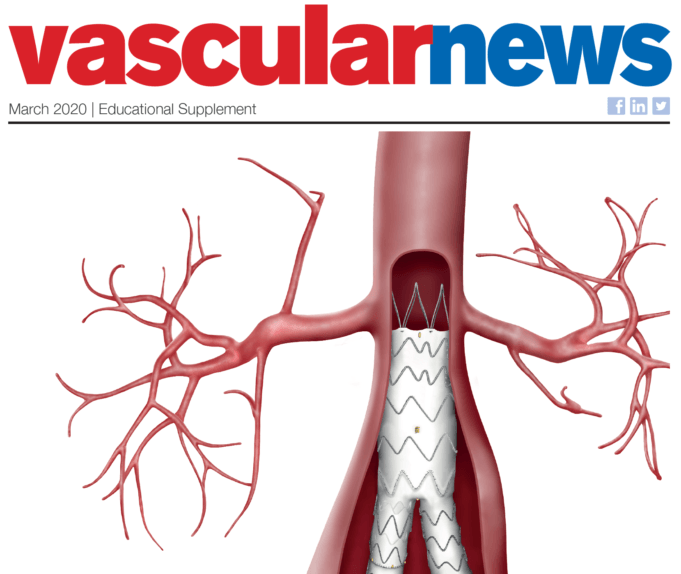 One solution for your aorto-iliac needs: A detailed look at the E-tegra and E-liac stent graft systems