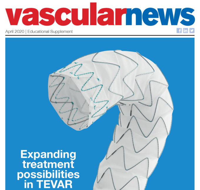 Expanding treatment possibilities in TEVAR