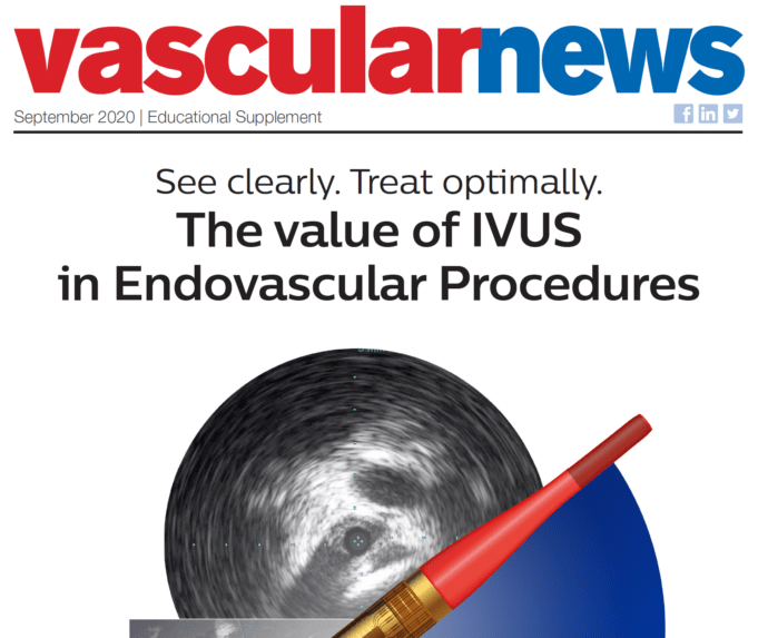 The value of IVUS in endovascular procedures