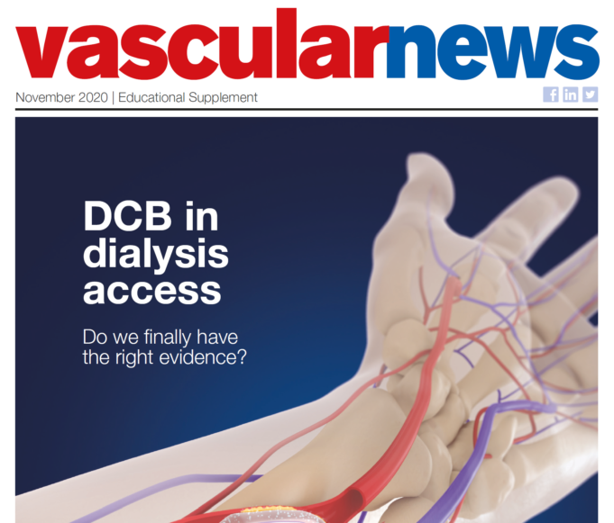 DCB in dialysis access: Do we finally have the right evidence?