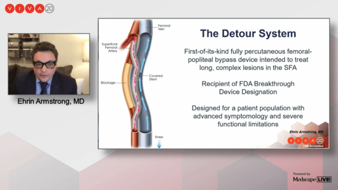 DETOUR I two-year outcomes: “Excellent” functional improvement in complex PAD cohort