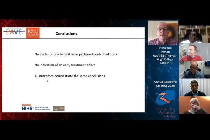 PAVE trial finds “no evidence of a benefit” from paclitaxel-coated balloons in preserving AV fistula patency PAVE
