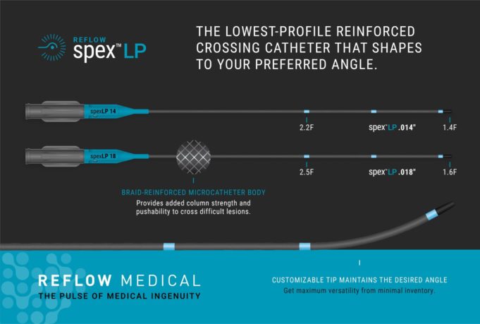 Reflow Medical introduces Spex LP shapeable reinforced support catheter
