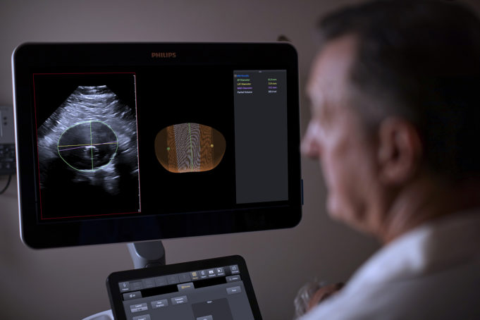 Philips introduces 3D ultrasound-based model for AAA surveillance