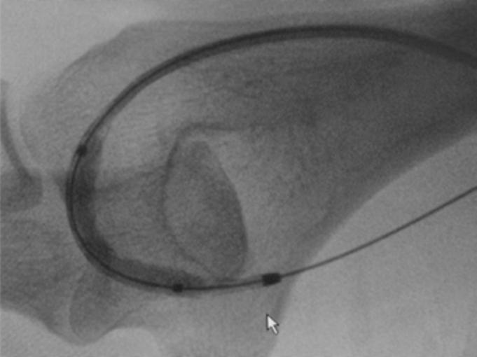 Transit Scientific announces close of its Series A financing round