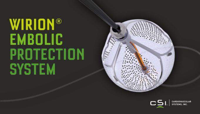 Cardiovascular Systems announces first uses of Wirion embolic protection system