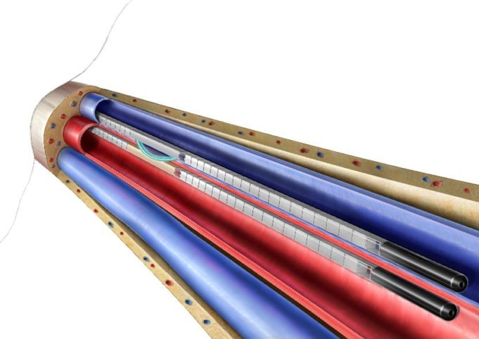 BD announces enrolment in postmarket studies of the WavelinQ endoAVF system