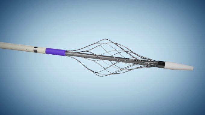 Surmodics builds thrombectomy portfolio with acquisition of Vetex Medical