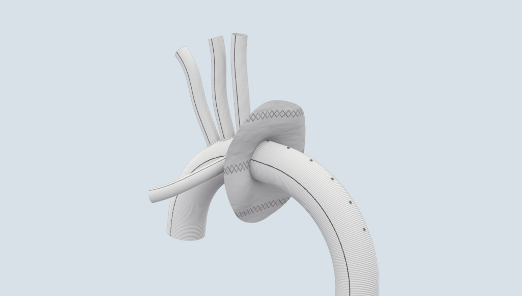 Terumo Aortic announces launch of landmark global surgical graft study