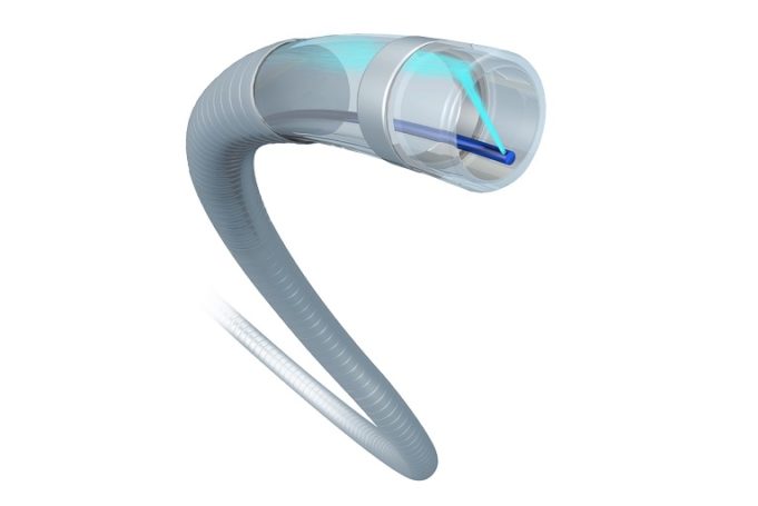 Abbott expands peripheral vascular offerings with acquisition of Walk Vascular