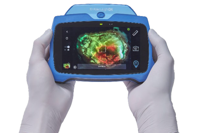 SWK Holdings provides US$10 million to MolecuLight to support global commercial expansion MolecuLightDX