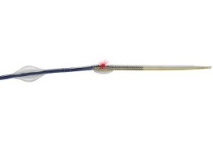 Avinger announces FDA clearance of Pantheris for the treatment of in-stent restenosis