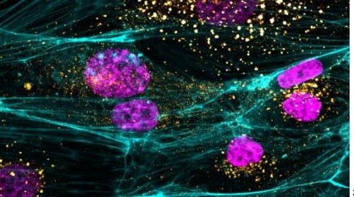 Vascular disease in COVID-19 is not caused by viral infection of blood vessels