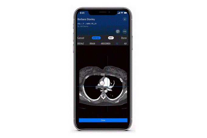 Viz.ai launches AI-powered modules for pulmonary embolism and aortic disease Viz.ai
