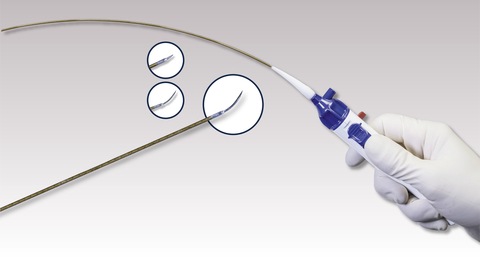 Study confirms efficiency of Upstream Peripheral’s GoBack catheter for ...