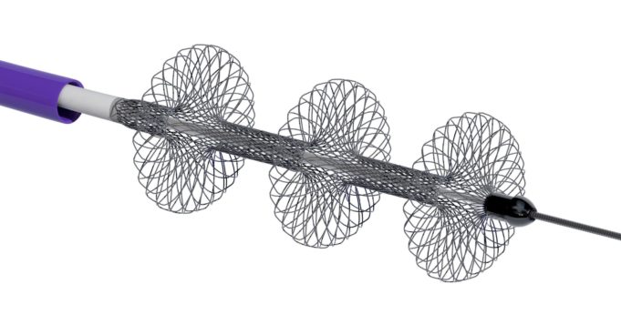 First patient enrolled in PEERLESS study of FlowTriever system