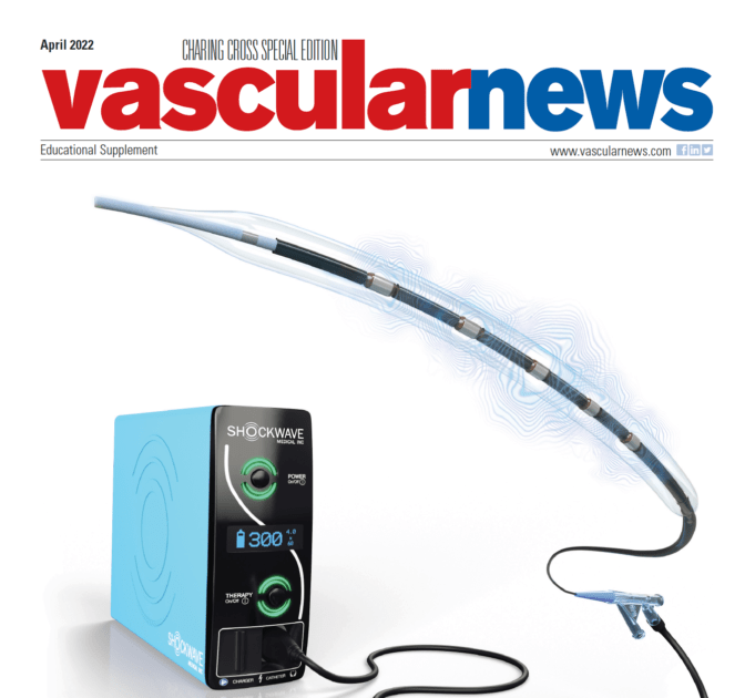 Confined by the complexity of calcium? Expand the boundaries with Shockwave M5+