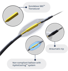 ultrasound renal denervation
