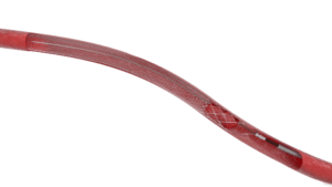 ClotTriever