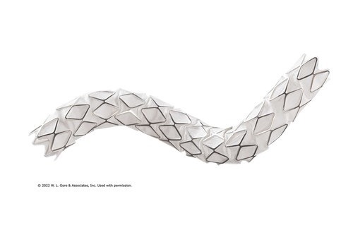 Gore completes enrolment in the VBX stent graft EXPAND registry