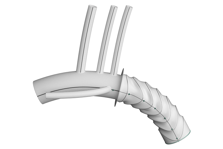 Terumo Aortic announces new technology add-on payment for Thoraflex ...