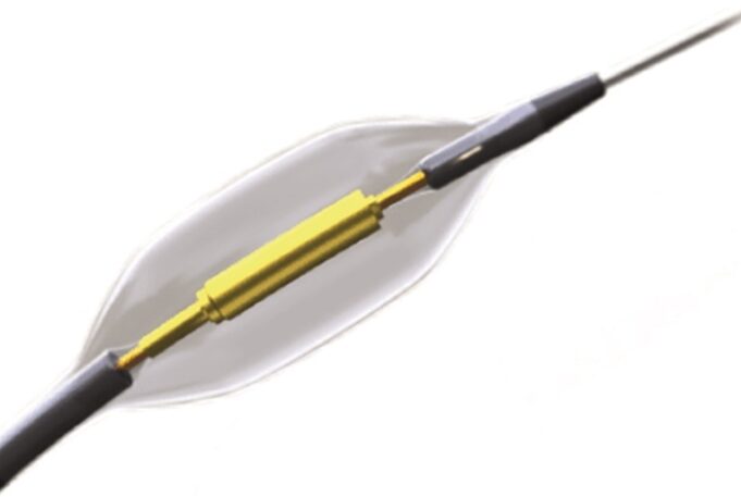 Results on ReCor Medical’s Paradise ultrasound renal denervation system published in two JAMA Network publications Paradise