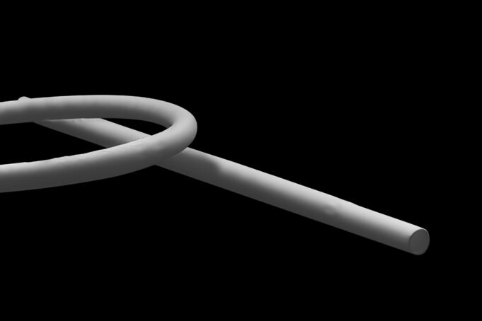 Xeltis starts pivotal clinical trial of “first-ever” restorative synthetic haemodialysis access graft