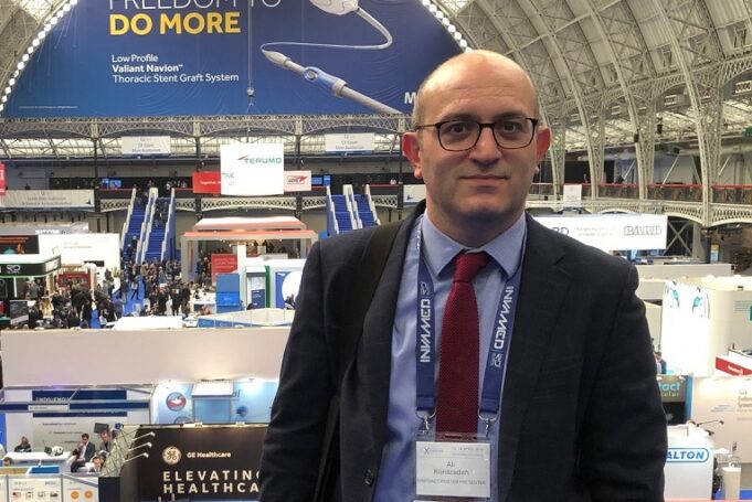 AI demonstrates potential to detect carotid artery disease on duplex ultrasound