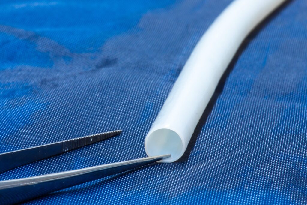 Mess Hav HAV remains durable at six years in PAD patients, study shows