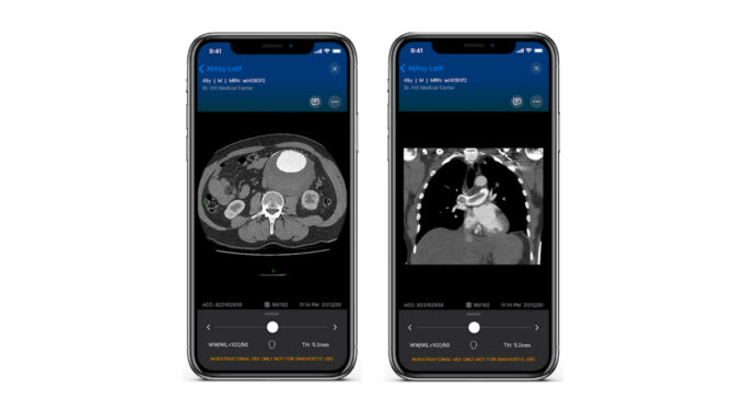 Viz.ai launches AI-powered Viz Vascular Suite